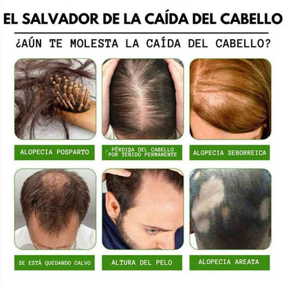 Serum 7 Days Para el Crecimiento de tu cabello