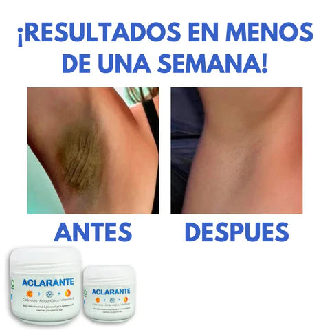 Crema Aclaradora Corporal