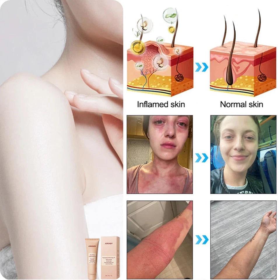 QUARXERY| EXFOLIANTE CORPORAL🫧~ACLARA LAS ZONAS NEGRAS DE LA PIEL!